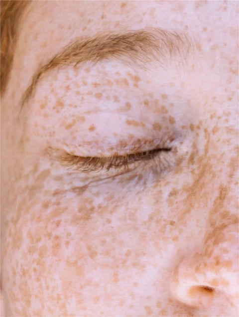 Luméra Vitamin C Serum