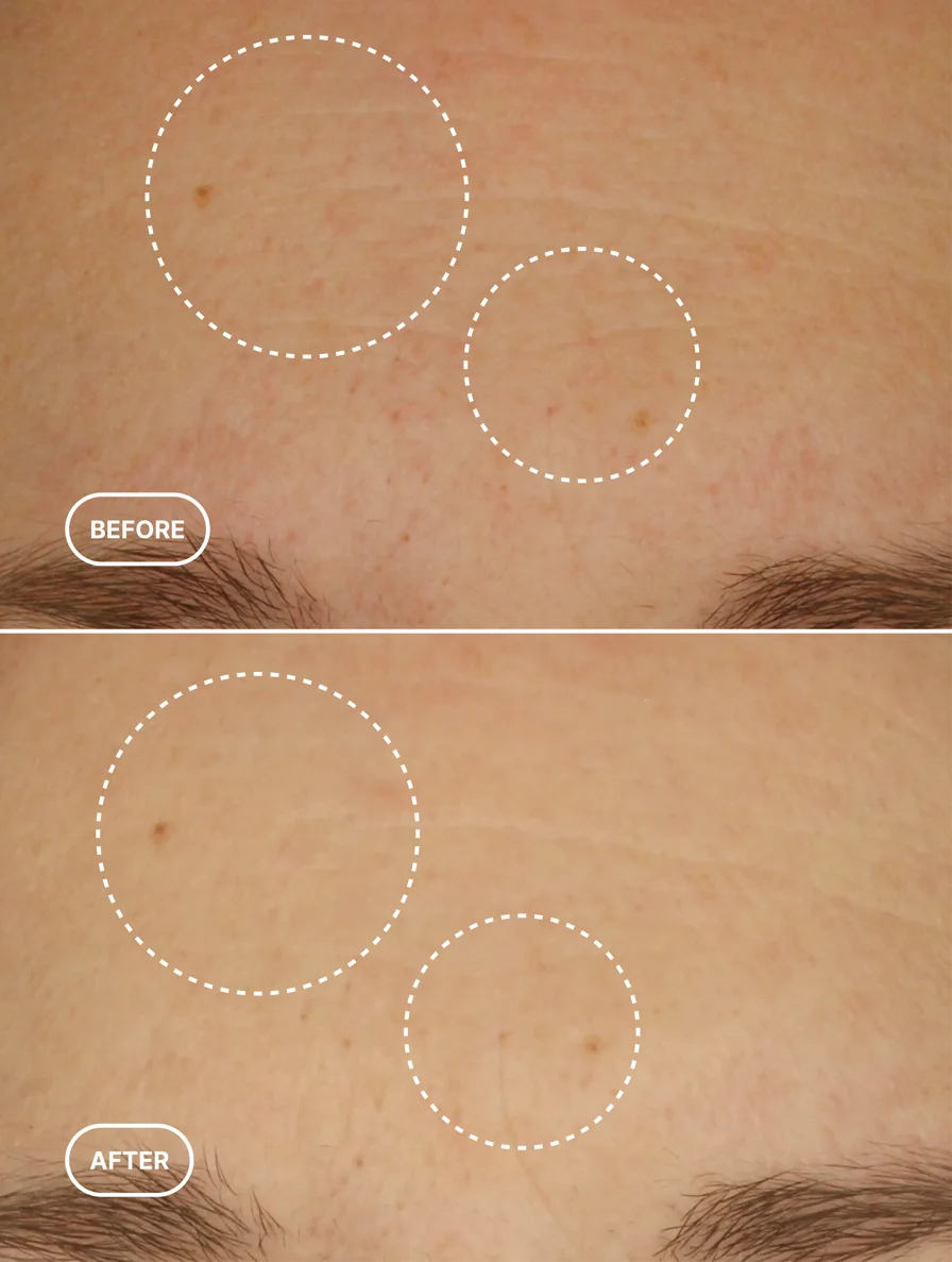 Luméra Retinol Alternative serum