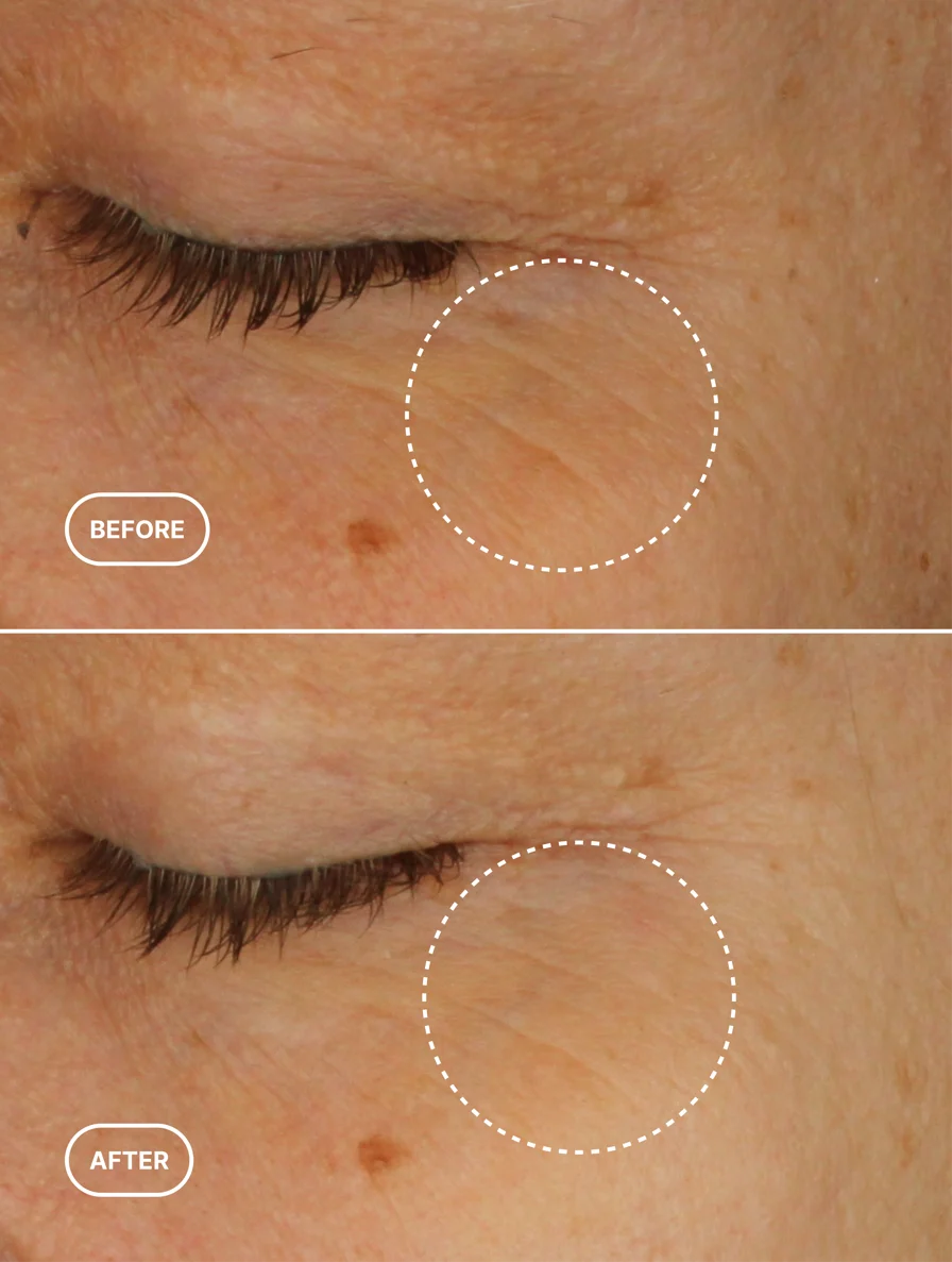 Luméra Retinol Alternative Eye Serum