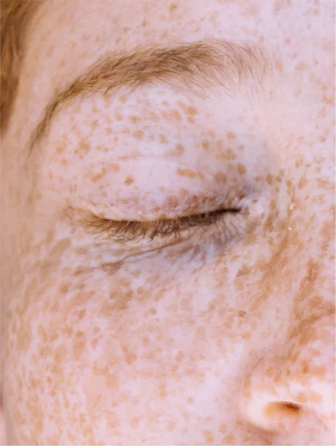 Luméra Spot Fade Kojic Corrector