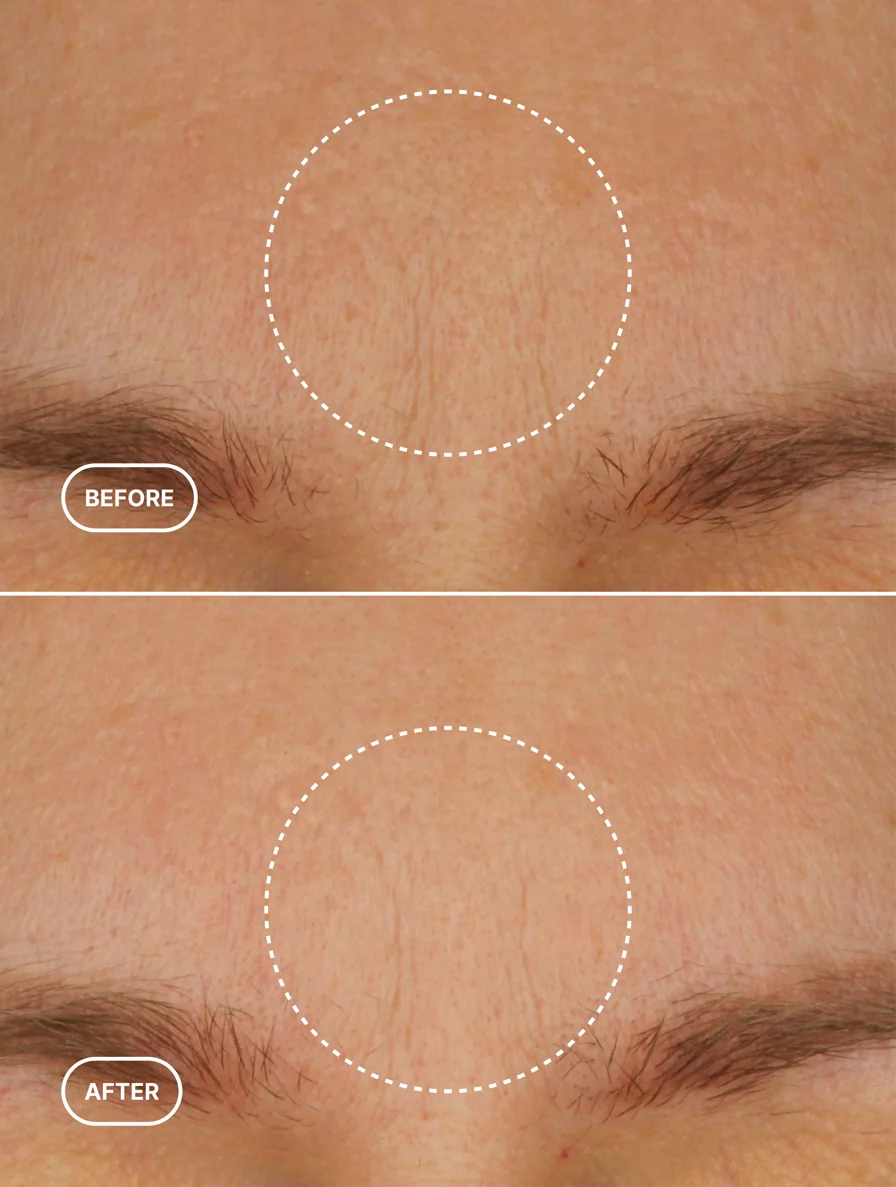 Luméra Age Renewal Moisturizer